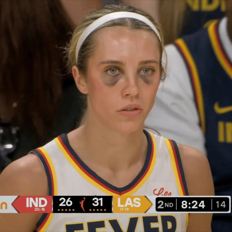 海洋之神·hy590官网-NBA Memes晒女球员眼眶乌黑图片：发生了什么？？？